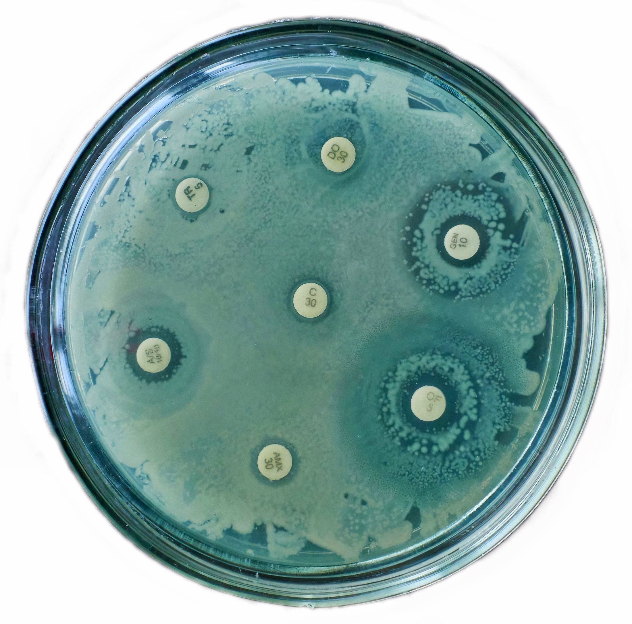 Petri dishes demonstrate the effect of antibiotics on bacteria, showing the longevity of anti-microbial resistant bacteria.