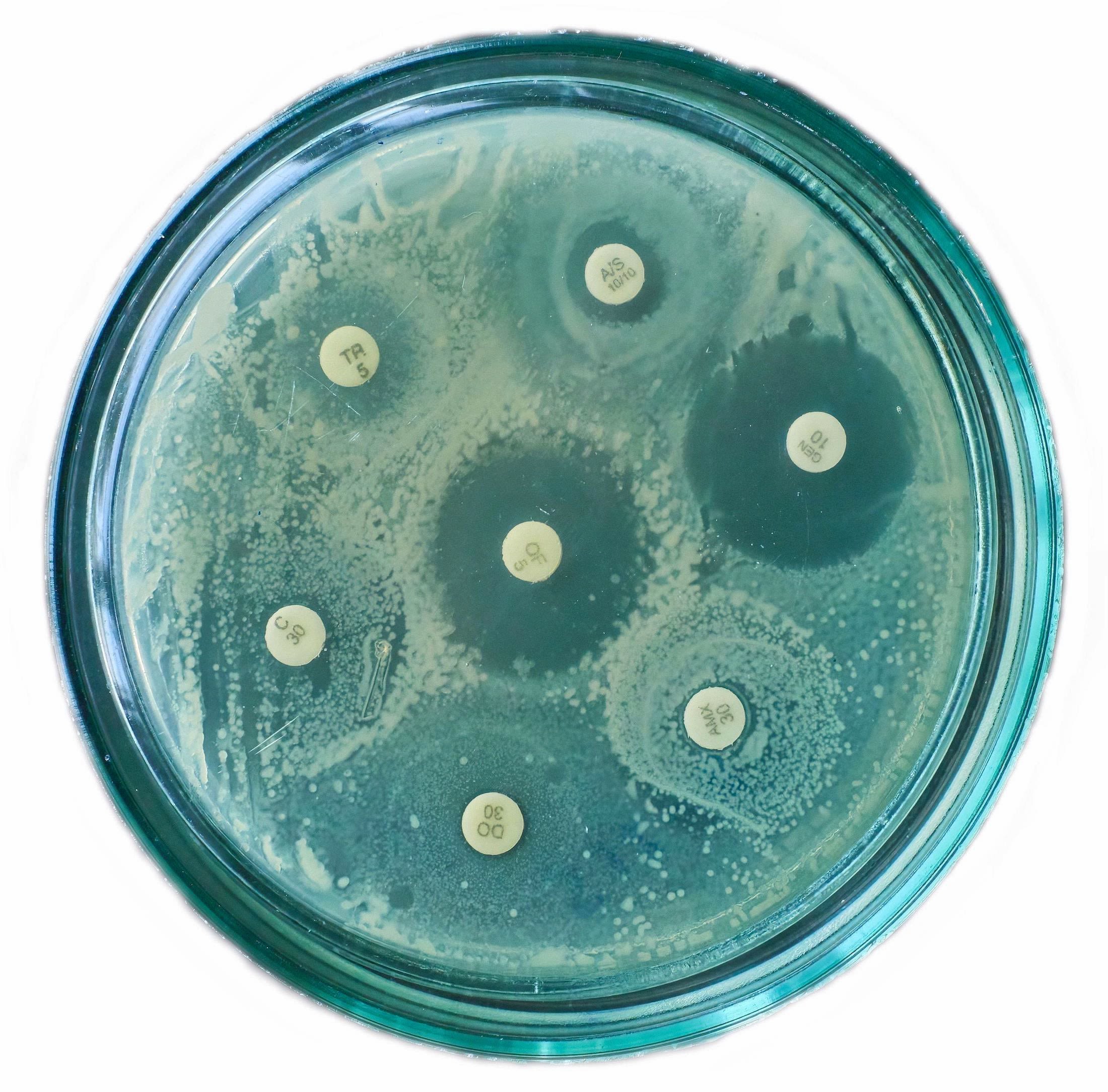 Petri dishes demonstrate the effect of antibiotics on bacteria, showing the longevity of anti-microbial resistant bacteria.